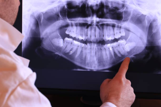 Best Emergency Treatment for Dental Infections or Abscesses in Lufkin, TX