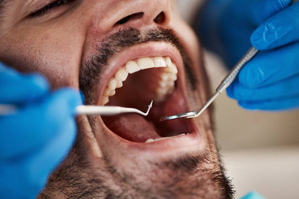 Best Cosmetic Emergency Dentistry in Lufkin, TX