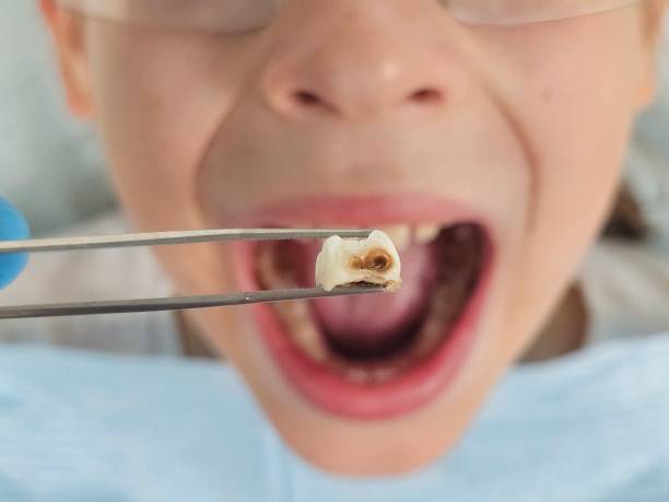 Best Same-Day Emergency Dental Services in Lufkin, TX